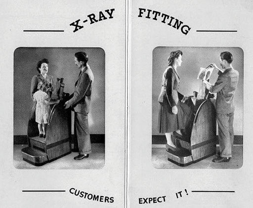 Fluoroscopic X-ray was in daily use at shoe shops for fittings until the late 1960s